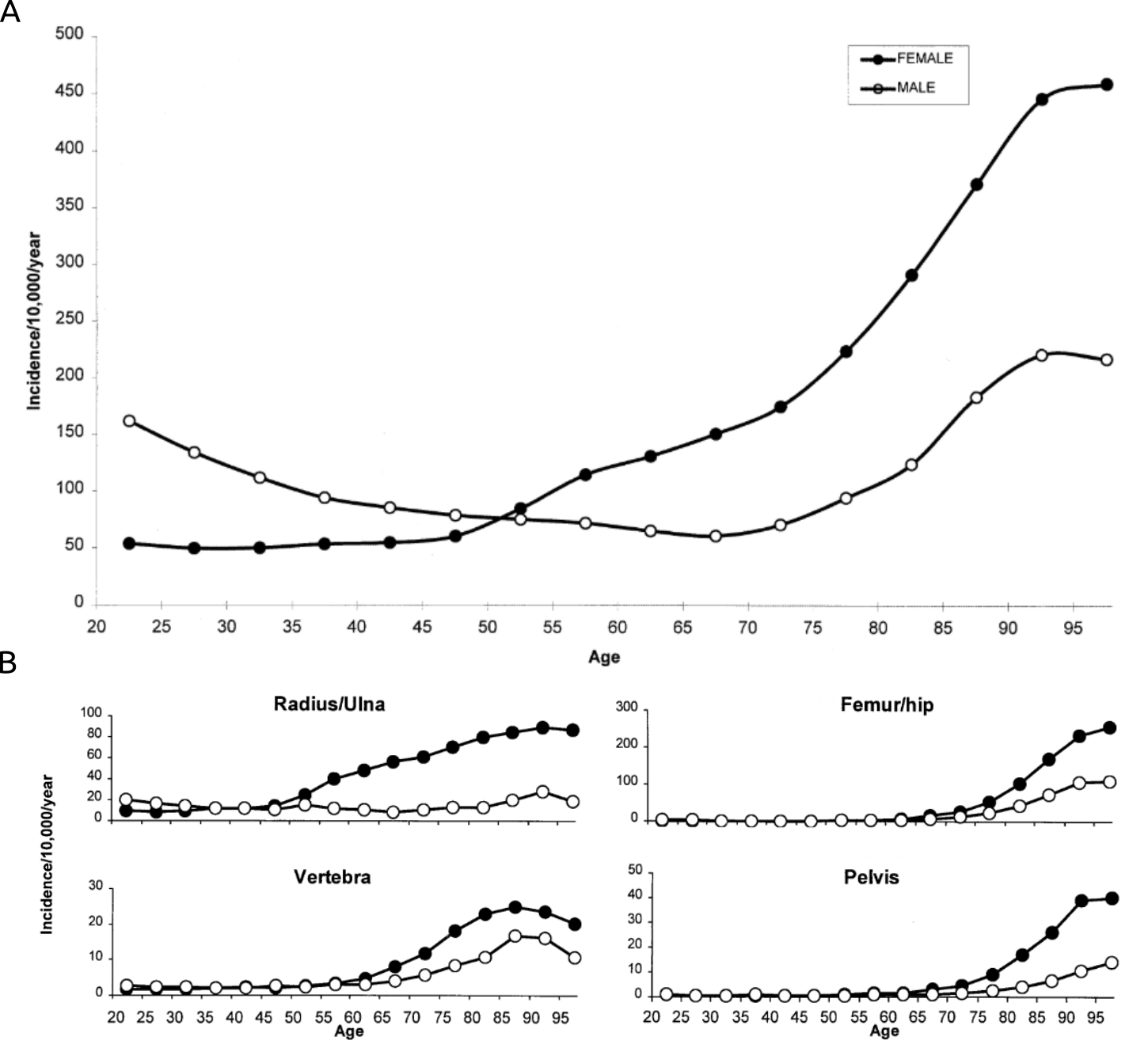 Overall Fracture Incidence Increases With Age Data from 5 million adults in the General Practice Research Database 1988-1998. A Incidence of all fractures at any site by sex and age. B Fractures by sex and age at select sites, pelvis, Femur/Hip & Vertebra confer the greatest increased mortality rates and Radius/Ulna has the greatest sexual dimorphism. (Adapted from van Staa et al. [238].)